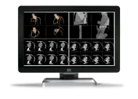 Barco MDCC-6430 -