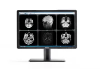 Barco MDRC-2222 TS - 22-дюймовый дисплей для просмотра клинических изображений