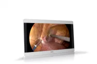 Barco MDSC-8231 - Хирургический дисплей с разрешением 4K UHD