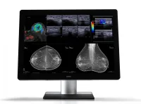 Barco MDMC-12133 Coronis Unity 12MP 33" - 12-мегапиксельный диагностический дисплей для изображений PACS, включая визуализацию молочной железы.