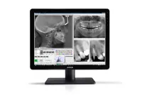Barco Nio 2MP Color Dental (MDNC-2123) - Диагностический 2-мегапиксленый монитор для стоматологического кабинета