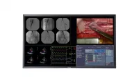 Barco MDSC-8358 - Хирургический дисплей с разрешением 4K UHD