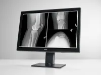 Barco MDCC-4430 - Диагностическая система мультимодального отображения с разрешением 4 Мпикс