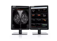 Мед.система Barco: пара MDNC-6121 Nio Color 5.8MP 21"  (Без НДС)