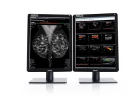 Монитор Barco MDNC-6121 Nio Color 5.8MP 21" (БЕЗ НДС)