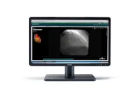 Barco MDRC-2222 BL - 22-дюймовый дисплей для просмотра клинических изображений