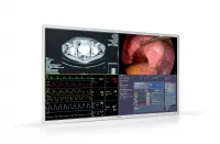 Barco MDSC-8255 - Хирургический дисплей с большим экраном разрешением 4K UHD